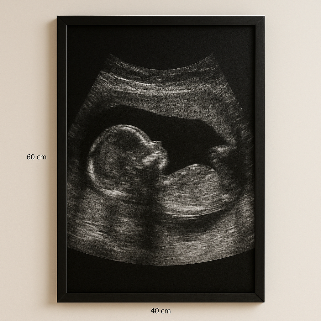 Cadre 40x60 avec Poster Personnalisé
