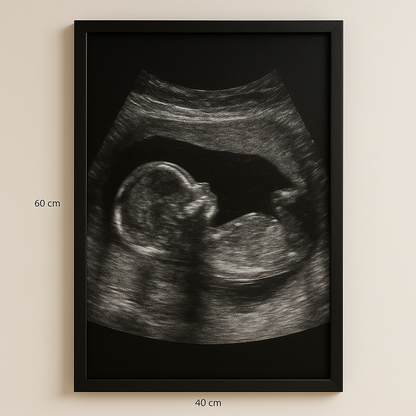 Cadre 40x60 avec Poster Personnalisé